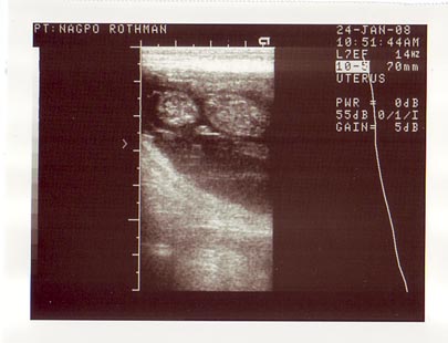 ultrasound1242008web.jpg